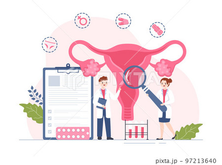 Endometriosis with Condition the Endometrium Grows Outside the Uterine Wall in Women for Treatment in Flat Cartoon Hand Drawn Templates Illustration Endometriosis with Condition the Endometrium Grows Outside the Uterine Wall in Women for Treatment in Flat Cartoon Hand Drawn Templates Illustration 97213640