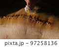 Surgical suture on the knee. Surgical wound sutured with special metal suture for healing. Total knee joint replacement. Close-up. 97258136