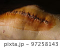Surgical suture on the knee. Surgical wound sutured with special metal suture for healing. Total knee joint replacement. Close-up. 97258143