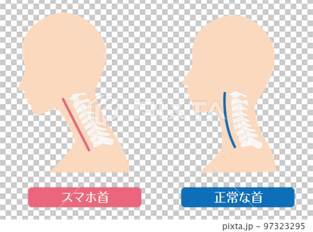 Smartphone neck straight neck Smartphone neck straight neck 97323295