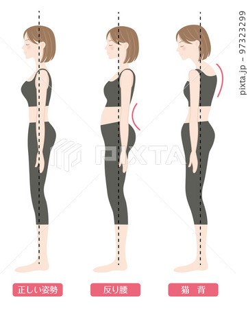 正しい姿勢と悪い姿勢(反り腰と猫背) 正しい姿勢と悪い姿勢(反り腰と猫背) 97323299