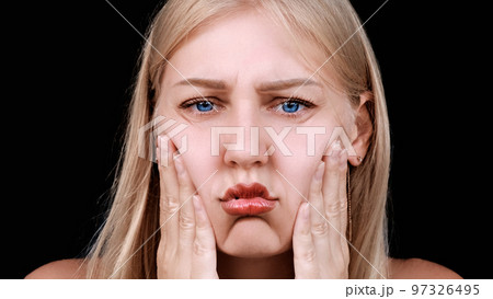 Second chin, obesity. Portrait of a 30-year-old woman pulling back the skin on her chin looks into the camera with a frustrated look. Problems of aging and appearance. Facelift, plastic surgery 97326495