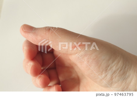 傷を負った指 傷を負った指 97463795