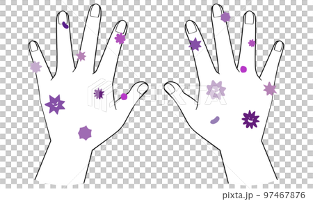 滿手細菌的手背插畫 97467876