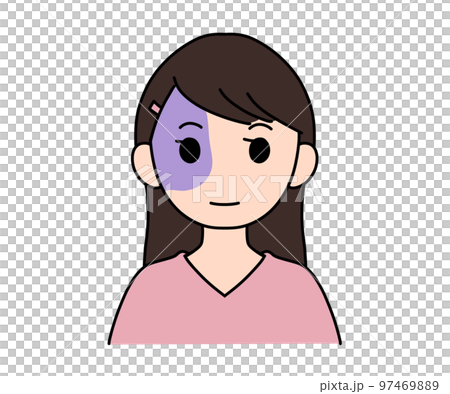 太田痣 太田痣 97469889