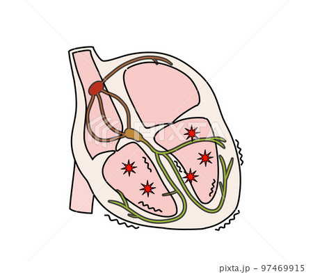 心室細動 心室細動 97469915