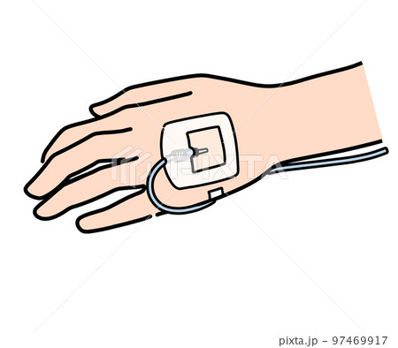 静脈ルート留置 静脈ルート留置 97469917