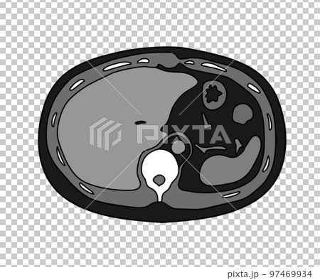 Multi-slice CT (abdomen) 97469934