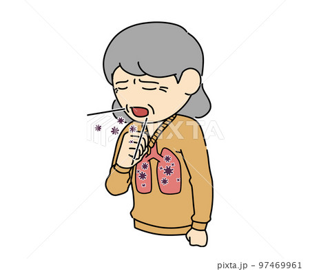 肺炎 肺炎 97469961