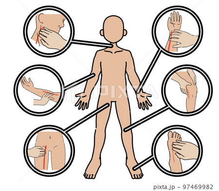 動脈蝕知 97469982