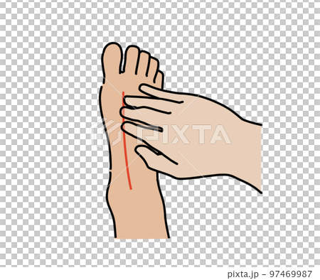 dorsalis pedis palpable 97469987