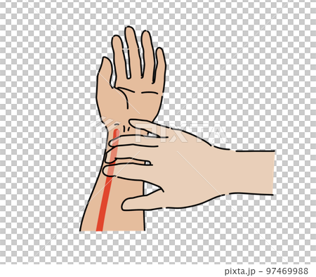 radial artery palpation 97469988