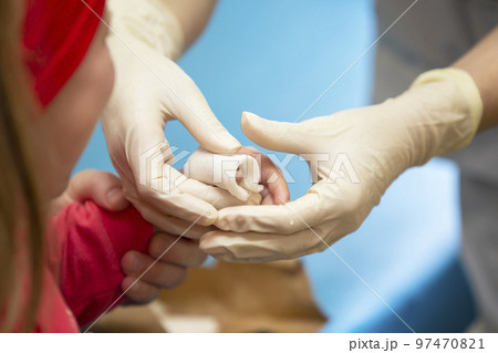 The hands of the doctor bandage the sore finger with a bandage of the child. Injury and wound on the finger in children The hands of the doctor bandage the sore finger with a bandage of the child. Injury and wound on the finger in children 97470821