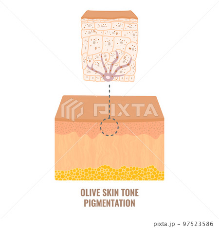 Olive skin tone pigmentation mechanism medical diagram 97523586