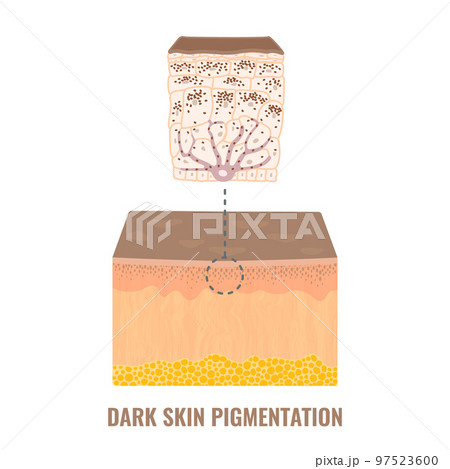 Skin tone pigmentation mechanism in dark skin 97523600