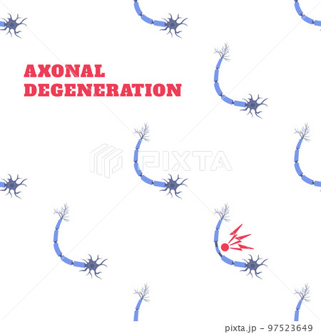 Axonal nerve degeneration disease awareness neuron pattern 97523649
