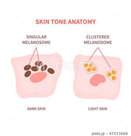 Melanosome distribution in dark and light skin 97523688
