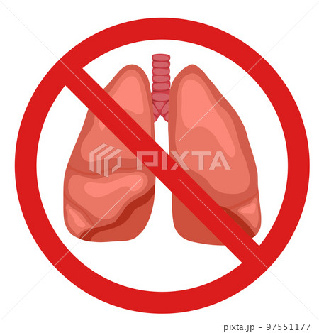 Anatomical vector illustration of human lungs in forbidden sign isolated from background. Transplant ban. Cartoon human body organ. 97551177
