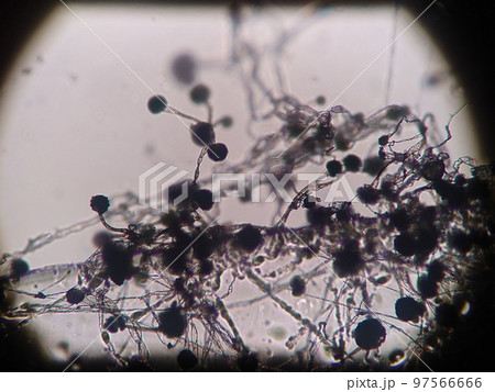 クモノスカビが生育した培地 97566666