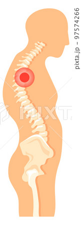 Human figure with spine pain side view. Anatomy illustration Human figure with spine pain side view. Anatomy illustration 97574266