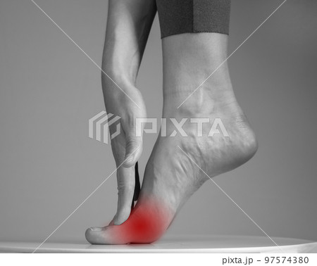 Pain in ball of foot. Woman holding leg with red spot closeup. Ache in metatarsal heads. Intense physical activity, inflammation consequences. Health care and medicine concept. Black and white Pain in ball of foot. Woman holding leg with red spot closeup. Ache in metatarsal heads. Intense physical activity, inflammation consequences. Health care and medicine concept. Black and white 97574380