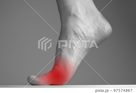 Woman foot with pain in ball with red point closeup. Intense physical activity, inflammation consequences. Health care and medicine concept. Black and white Woman foot with pain in ball with red point closeup. Intense physical activity, inflammation consequences. Health care and medicine concept. Black and white 97574867