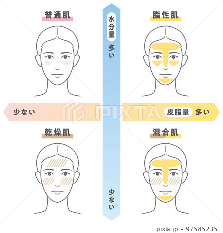 肌質チェック（女性） 97585235