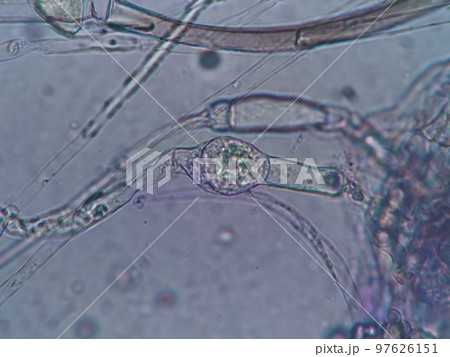 有性生殖接合をおこしたカビ 97626151