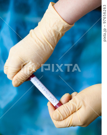 Hands holding blood test result for Coronavirus 97656263