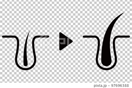 AGA (thinning hair treatment) treatment image icon, AGA image 97696388