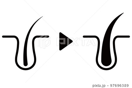 AGA（薄毛治療）の治療イメージアイコン、AGAのイメージ 97696389