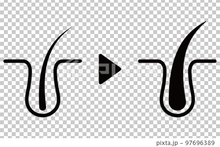 AGA（薄毛治療）の治療イメージアイコン、AGAのイメージ 97696389