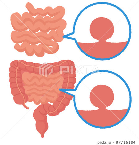 小腸ポリープのイラスト 97716184