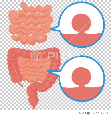 小腸ポリープのイラスト 97716184