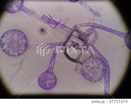 接合胞子の顕微鏡写真アップ 97751074
