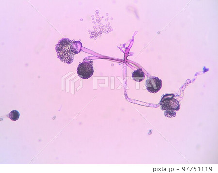 接合菌類リゾープス属の仮根 接合菌類リゾープス属の仮根 97751119