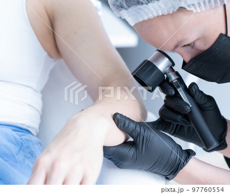 A dermatologist examines a patient's mole through a dermatoscope. A dermatologist examines a patient's mole through a dermatoscope. 97760554