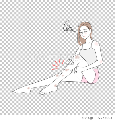 Female legs, bruises, dark spots, beauty spots, troubles, skin troubles 97764003