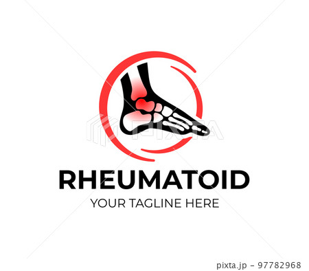 Foot with bones, ankle joint inflammation in circle, logo design. Healthcare, medicine, rheumatology and traumatology, vector design and illustration Foot with bones, ankle joint inflammation in circle, logo design. Healthcare, medicine, rheumatology and traumatology, vector design and illustration 97782968