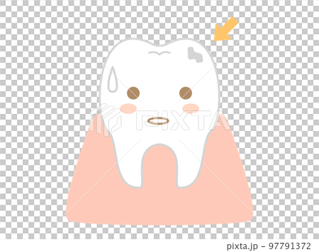 想像蛀牙的插圖 97791372