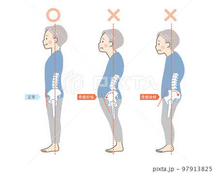 シニア男性の良い姿勢と悪い姿勢の見本_骨盤 97913825