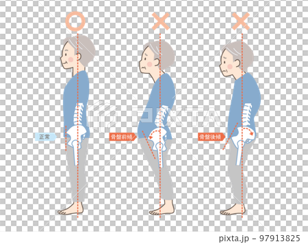 シニア男性の良い姿勢と悪い姿勢の見本_骨盤 97913825