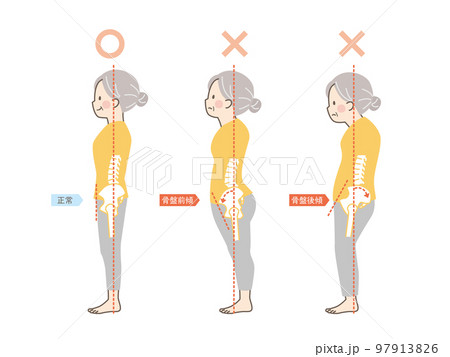シニア女性の良い姿勢と悪い姿勢の見本_骨盤 97913826