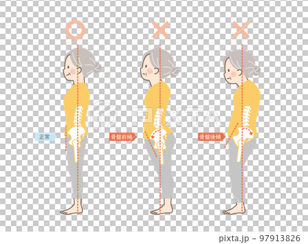 シニア女性の良い姿勢と悪い姿勢の見本_骨盤 97913826