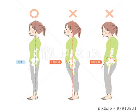 女性の良い姿勢と悪い姿勢の見本_骨盤 女性の良い姿勢と悪い姿勢の見本_骨盤 97913831