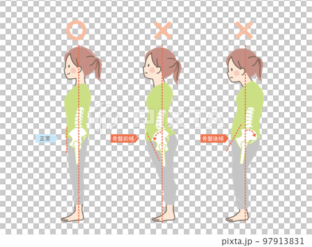 女性の良い姿勢と悪い姿勢の見本_骨盤 女性の良い姿勢と悪い姿勢の見本_骨盤 97913831