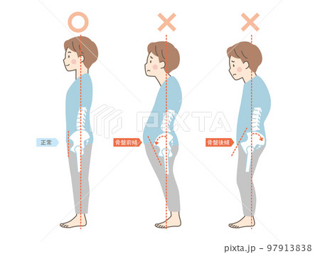 男性の良い姿勢と悪い姿勢の見本_骨盤 男性の良い姿勢と悪い姿勢の見本_骨盤 97913838