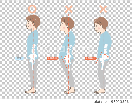 男性の良い姿勢と悪い姿勢の見本_骨盤 男性の良い姿勢と悪い姿勢の見本_骨盤 97913838