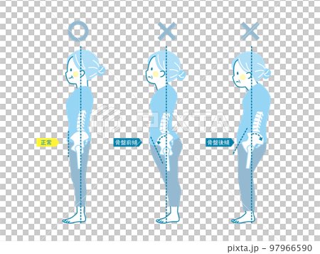 Sample of good and bad posture of senior women _ pelvis 97966590