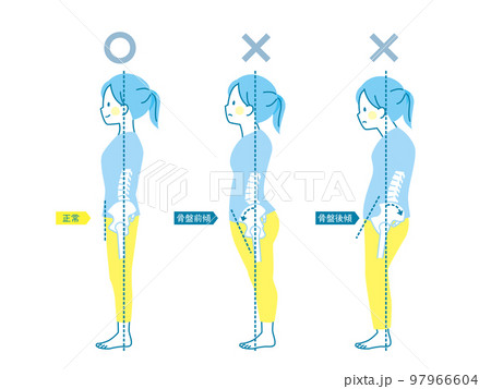 女性の良い姿勢と悪い姿勢の見本_骨盤 女性の良い姿勢と悪い姿勢の見本_骨盤 97966604